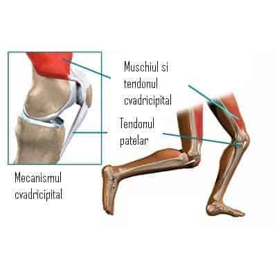 Ruptură Tendon Rotulian