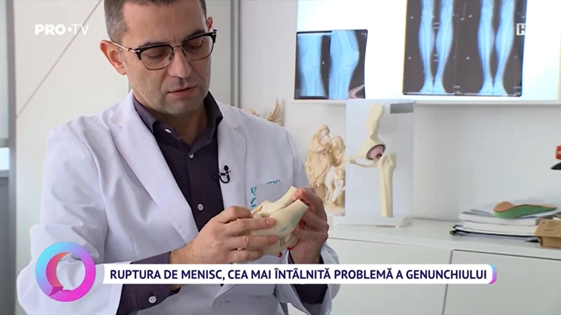 Ruptura de menisc