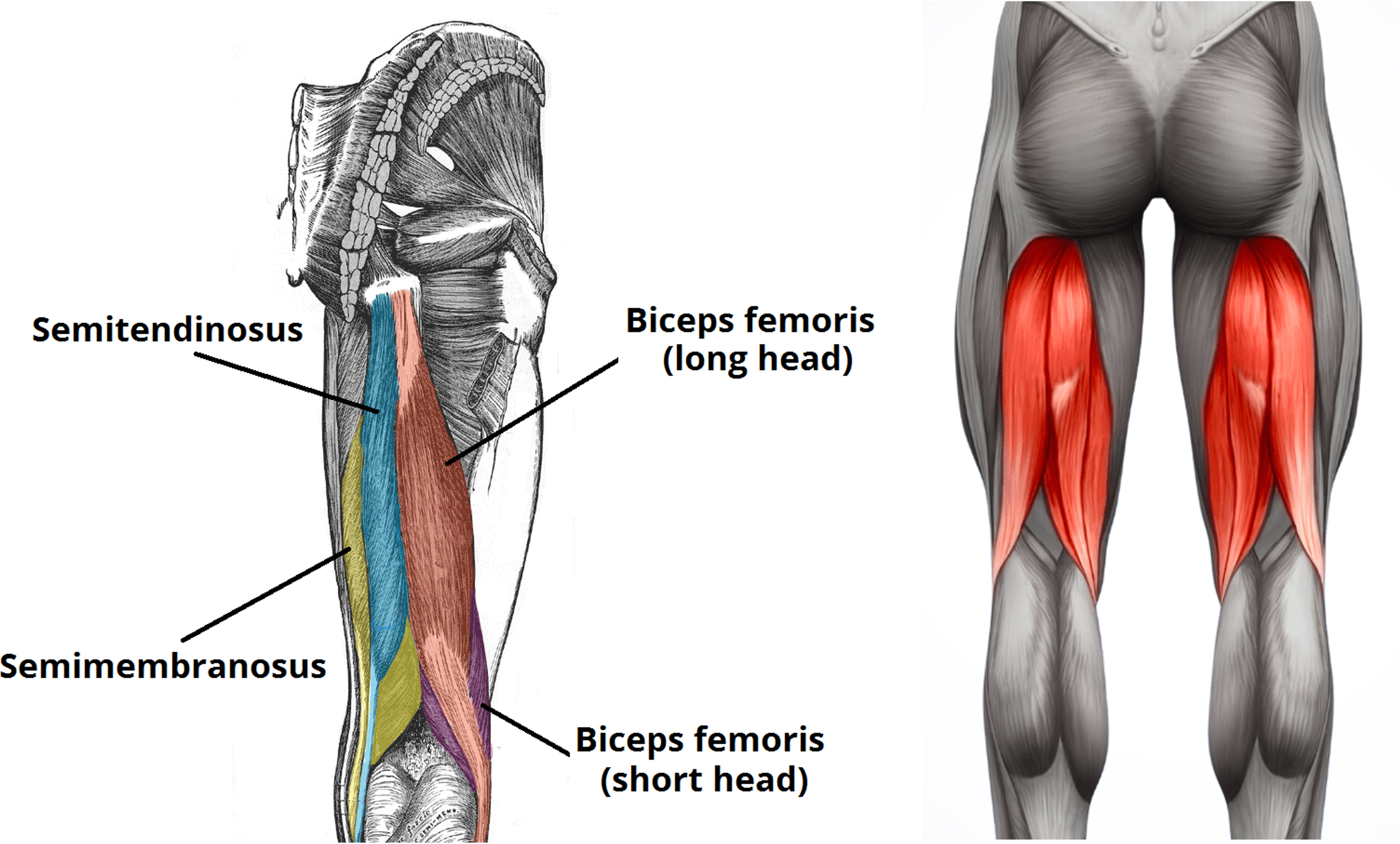 Leziunile de tendon biceps femural proximal si leziunile de tendon adductor lung proximal